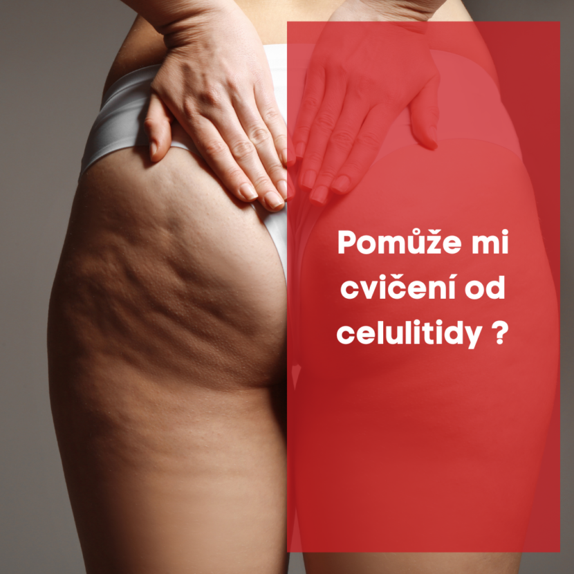 Pomůže mi cvičení od celulitidy ?